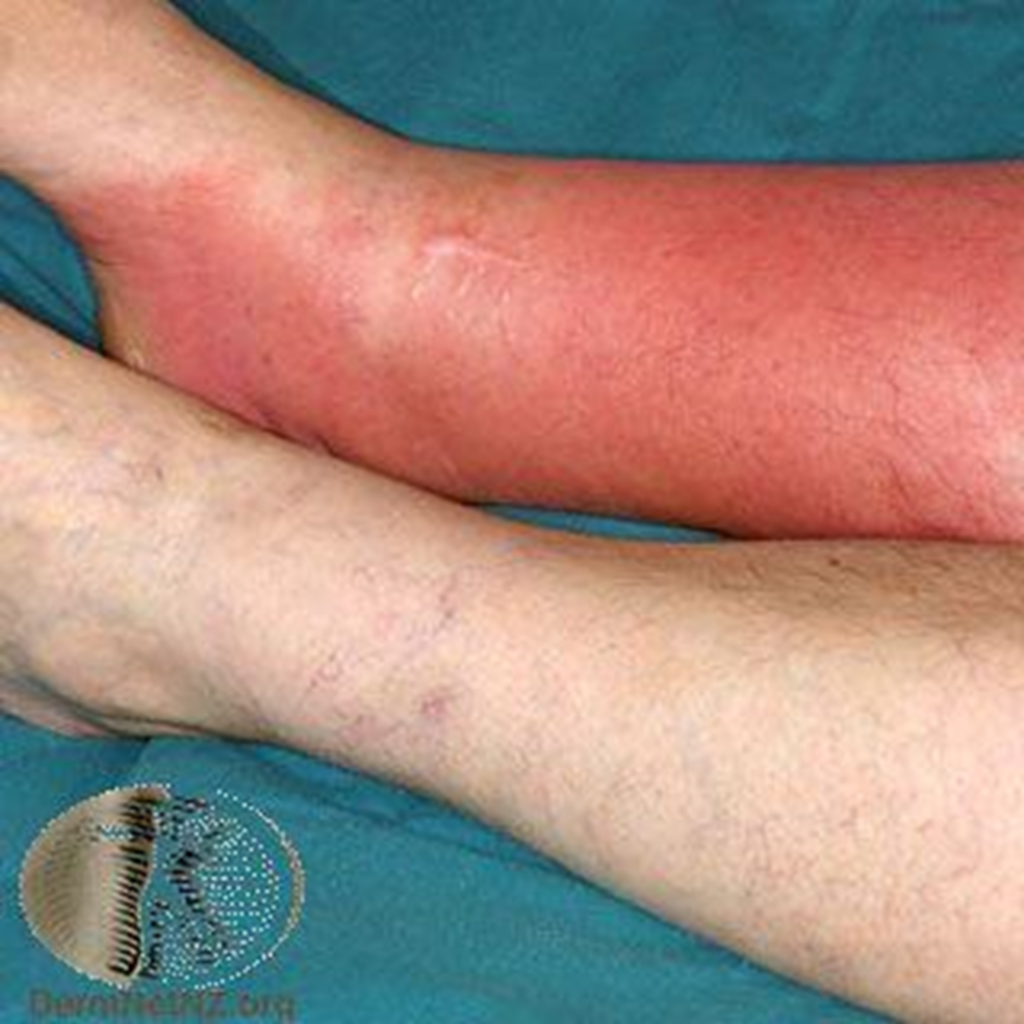 why-are-my-legs-red-and-itchy-after-shower-at-beulah-may-blog